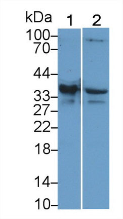 DAB staining on IHC-P; Samples: Human Cardiac Muscle Tissue;  Primary Ab: 20µg/ml Rabbit Anti-Human TNNT2 Antibody Second Ab: 2µg/mL HRP-Linked Caprine Anti-Rabbit IgG Polyclonal Antibody