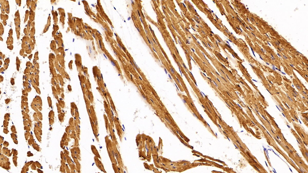 Troponin T Type 2, Cardiac (TNNT2) Polyclonal Antibody - image 4