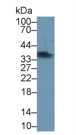 Western Blot; Sample: Recombinant protein.