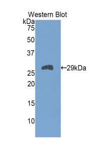 Troponin T Type 1, Slow Skeletal (TNNT1) Polyclonal Antibody - image 3