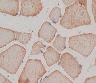 Troponin T Type 1, Slow Skeletal (TNNT1) Polyclonal Antibody - image 4