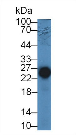 Western Blot; Sample: Recombinant protein.