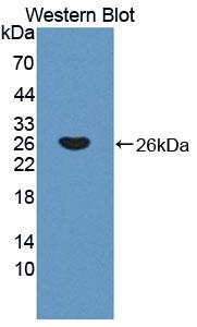 DAB staining on IHC-P; Samples: Mouse Skeletal muscle Tissue;  Primary Ab: 20μg/ml Rabbit Anti-Mouse TNNI2 Antibody Second Ab: 2µg/mL HRP-Linked Caprine Anti-Rabbit IgG Polyclonal Antibody