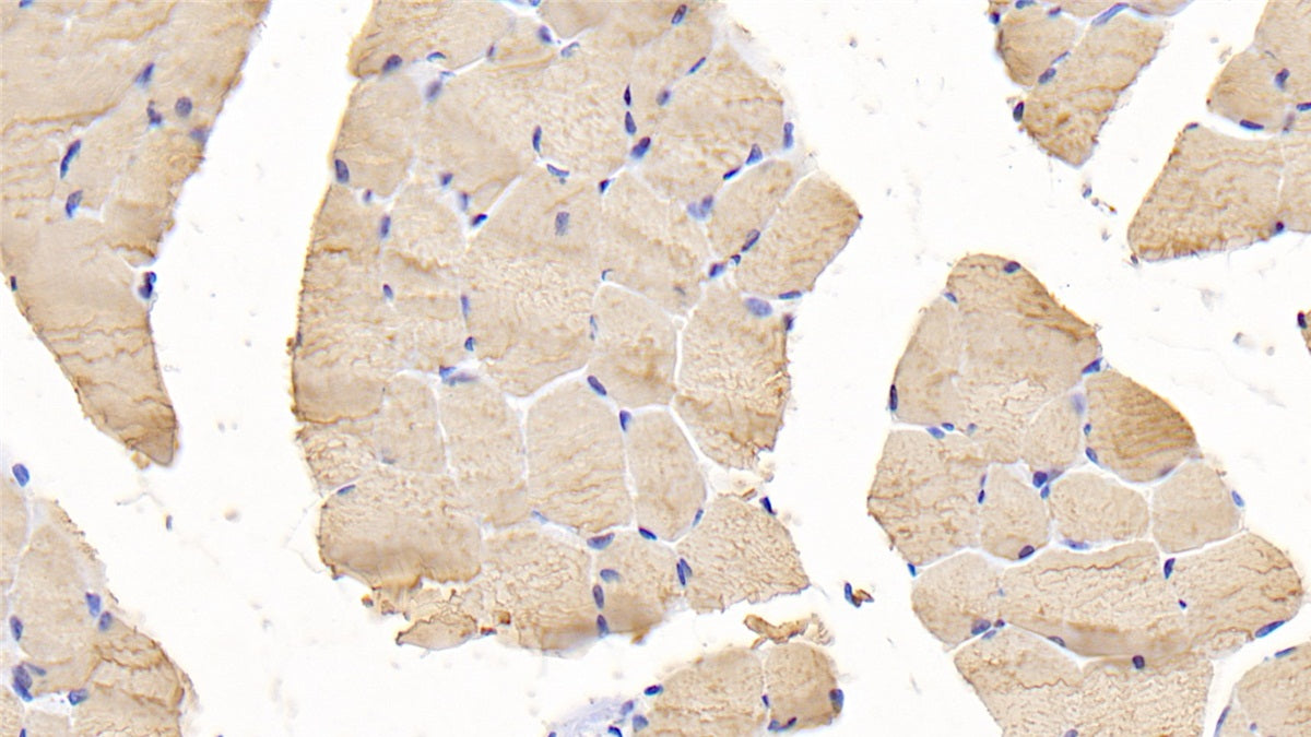 DAB staining on fromalin fixed paraffin-embedded heart tissue)