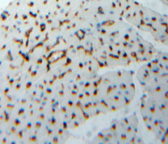Troponin I Type 2, Fast Skeletal (TNNI2) Polyclonal Antibody - image 5