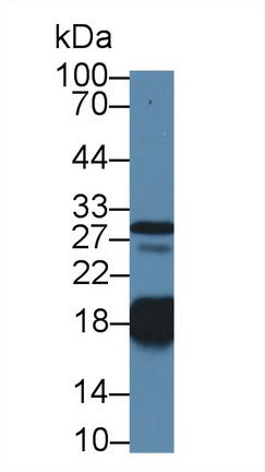 Western Blot; Sample: Recombinant protein.