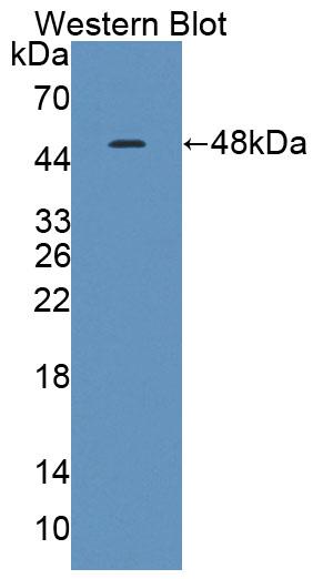 DAB staining on IHC-P; Samples: Human Cardiac Muscle Tissue; Primary Ab: 20μg/ml Rabbit Anti-Human TNNC1 Antibody Second Ab: 2µg/mL HRP-Linked Caprine Anti-Rabbit IgG Polyclonal Antibody