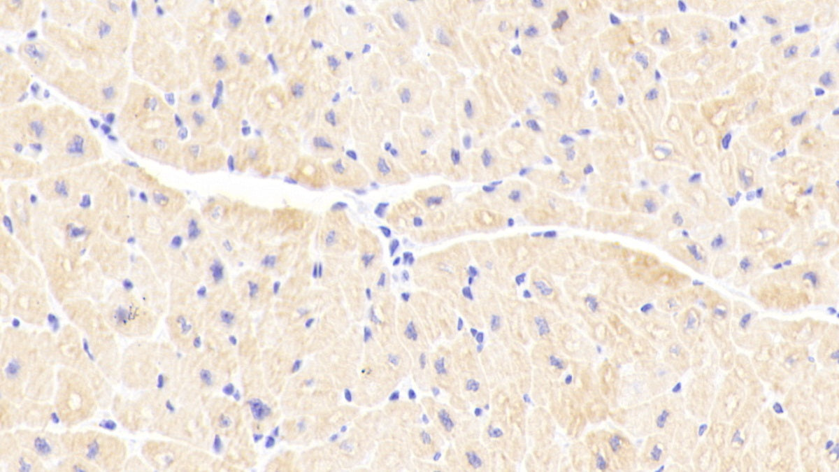 DAB staining on IHC-P. Samples: Human Tissue)