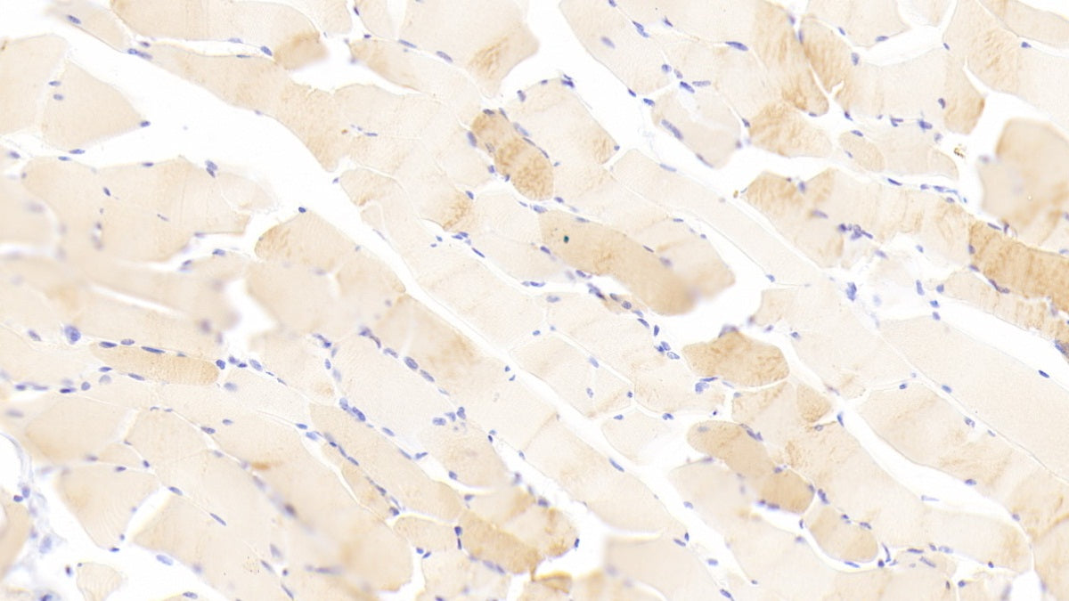 Troponin C Type 1, Slow (TNNC1) Polyclonal Antibody - image 5