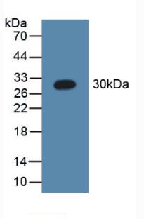 DAB staining on IHC-P; Samples: Human Brain Tissue; Primary Ab: 10µg/ml Rabbit Anti-Human C1qA Antibody Second Ab: 2µg/mL HRP-Linked Caprine Anti-Rabbit IgG Polyclonal Antibody