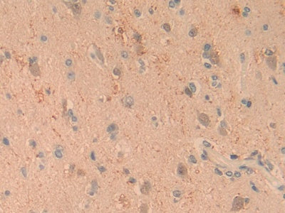 DAB staining on IHC-P; Samples: Human Kidney Tissue.