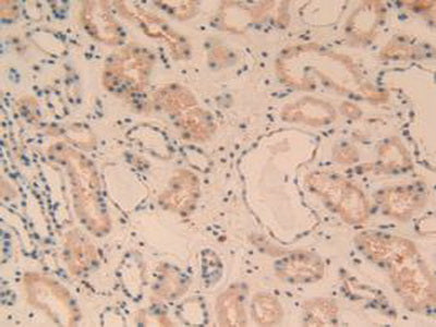 Complement Component 1, Q Subcomponent A (C1qA) Polyclonal Antibody - image 5