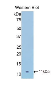 DAB staining on IHC-P; Samples: Mouse Oviduct Tissue; Primary Ab: 30µg/ml Rabbit Anti-Mouse COL2a1 Antibody Second Ab: 2µg/mL HRP-Linked Caprine Anti-Rabbit IgG Polyclonal Antibody