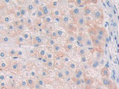 DAB staining on fromalin fixed paraffin- embedded kidney tissue)