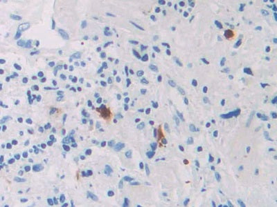 Ribonuclease A8 (RNASE8) Polyclonal Antibody - image 4