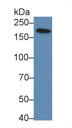 Figure. Western Blot; Sample: Recombinant XRN1, Rat.