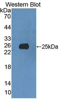 DAB staining on IHC-P; Samples: Rat Cerebrum Tissue; Primary Ab: 10μg/ml Rabbit Anti-Rat XRN1 Antibody Second Ab: 2µg/mL HRP-Linked Caprine Anti-Rabbit IgG Polyclonal Antibody
