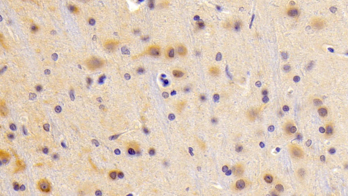 DAB staining on fromalin fixed paraffin- embedded stomach tissue)
