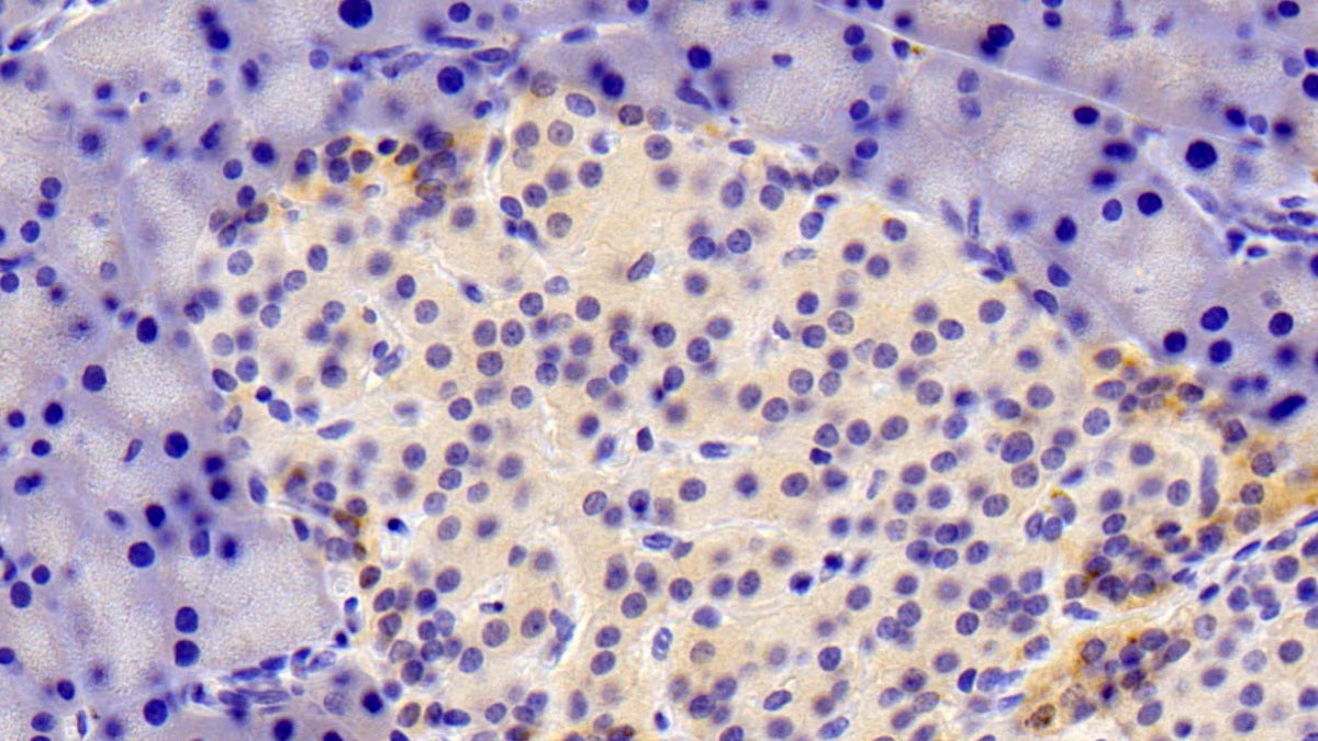 5'-3'Exoribonuclease 1 (XRN1) Polyclonal Antibody - image 5