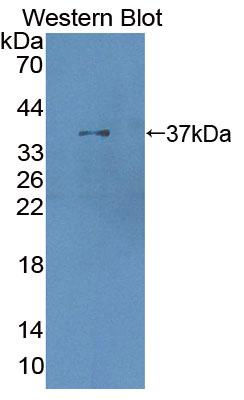5'-3'Exoribonuclease 1 (XRN1) Polyclonal Antibody - image 2