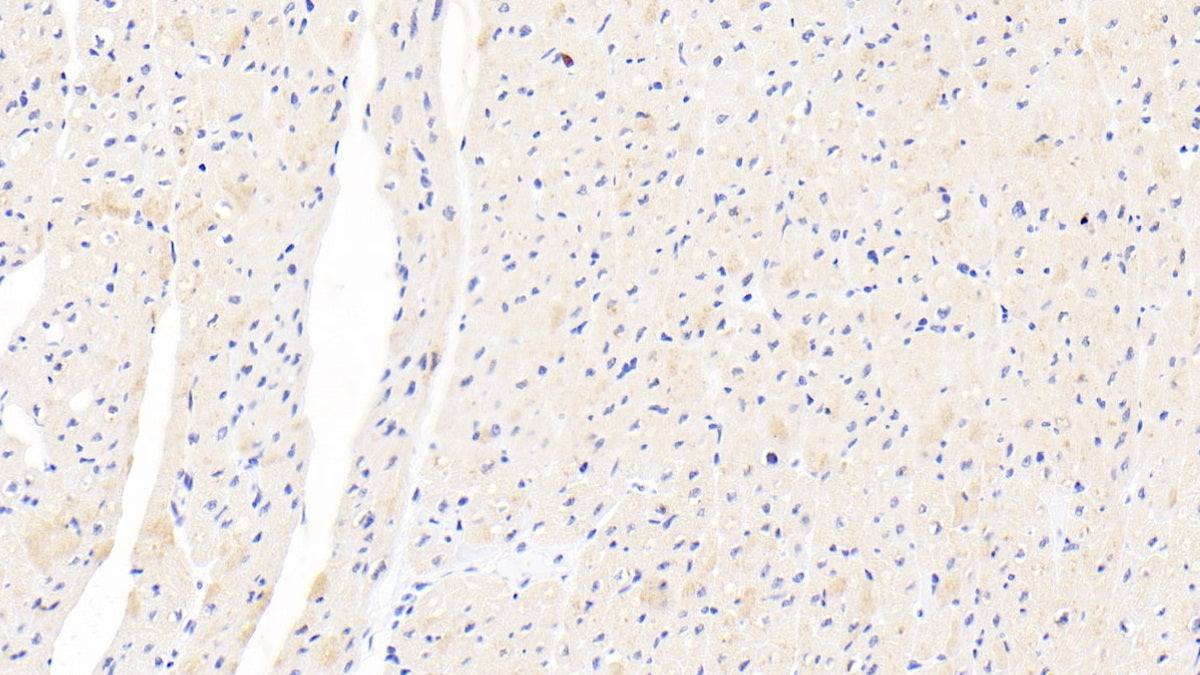 DAB staining on fromalin fixed paraffin- embedded pancreas tissue)