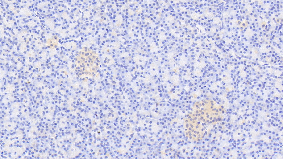 5'-3'Exoribonuclease 1 (XRN1) Polyclonal Antibody - image 4
