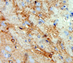 Chemokine C-C-Motif Ligand 4 Like Protein 1 (CCL4L1) Polyclonal Antibody - image 3