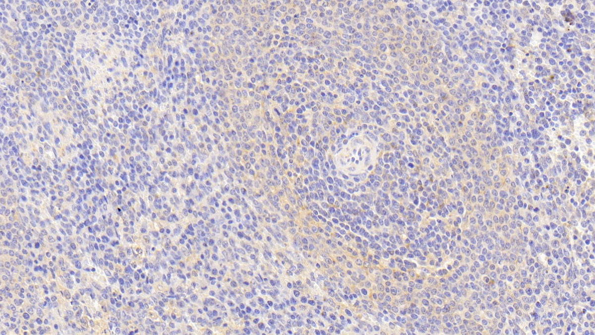 DAB staining on IHC-P; Samples: Human Lymph node Tissue;  Primary Ab: 20μg/ml Rabbit Anti-Human S100Z Antibody Second Ab: 2µg/mL HRP-Linked Caprine Anti-Rabbit IgG Polyclonal Antibody