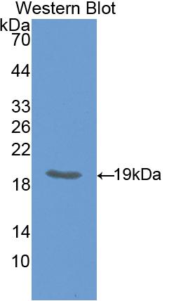 Hedgehog Homolog, Indian (IHH) Polyclonal Antibody - image 2