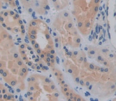 Hedgehog Homolog, Indian (IHH) Polyclonal Antibody - image 3