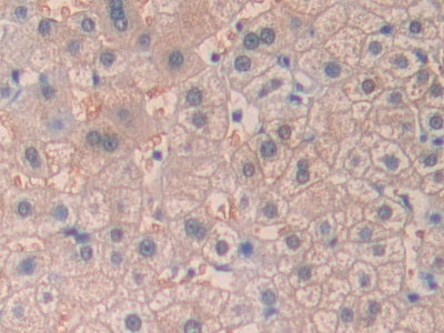 DAB staining on fromalin fixed paraffin-embedded Kidney tissue)