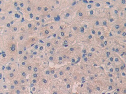 Hedgehog Homolog, Desert (DHH) Polyclonal Antibody - image 4