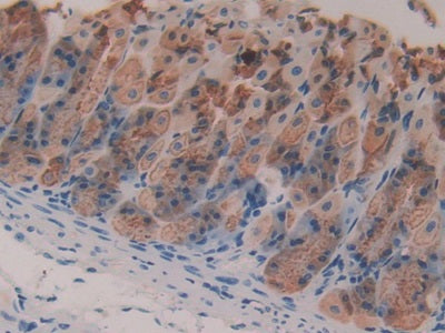 Gastric Intrinsic Factor (GIF) Polyclonal Antibody - image 5