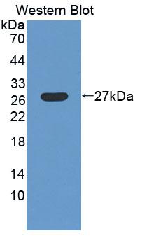 Low Density Lipoprotein Receptor Related Protein 1B (LRP1B) Polyclonal Antibody - image 2