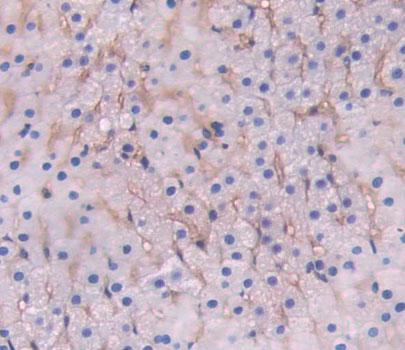 Low Density Lipoprotein Receptor Related Protein 1B (LRP1B) Polyclonal Antibody - image 3