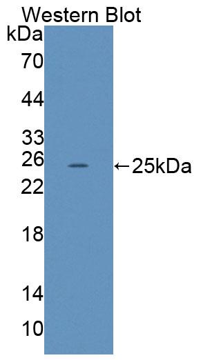 Low Density Lipoprotein Receptor Related Protein 2 (LRP2) Polyclonal Antibody - image 2