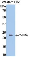 DAB staining on IHC-P; Samples: Mouse Pancreas Tissue; Primary Ab: 20μg/ml Rabbit Anti-Mouse HBb Antibody Second Ab: 2µg/mL HRP-Linked Caprine Anti-Rabbit IgG Polyclonal Antibody
