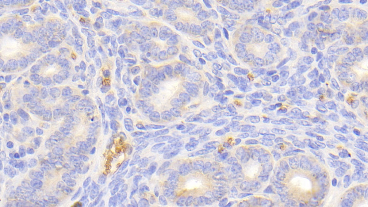 Hemoglobin Beta (HBb) Polyclonal Antibody - image 5