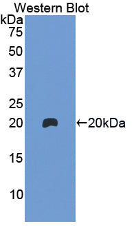 Hemoglobin Beta (HBb) Polyclonal Antibody - image 3