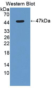 DAB staining on IHC-P; Samples: Rat Lymph node Tissue; Primary Ab: 20µg/ml Rabbit Anti-Rat ACP6 Antibody Second Ab: 2µg/mL HRP-Linked Caprine Anti-Rabbit IgG Polyclonal Antibody