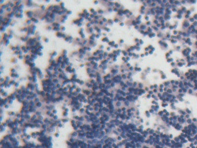 DAB staining on fromalin fixed paraffin- embedded kidney tissue)