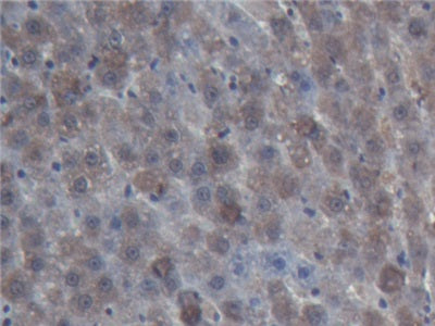 Acid Phosphatase 6, Lysophosphatidic (ACP6) Polyclonal Antibody - image 5