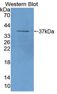 Arachidonate-12-Lipoxygenase, 12R Type (ALOX12B) Polyclonal Antibody - image 2