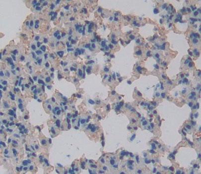 Arachidonate-12-Lipoxygenase, 12R Type (ALOX12B) Polyclonal Antibody - image 3