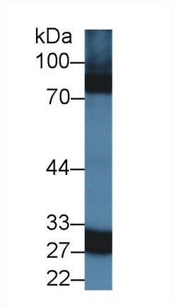 Western Blot; Sample: Recombinant protein.