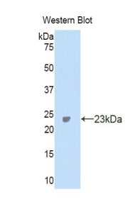 Carbonic Anhydrase VA (CA5A) Polyclonal Antibody - image 2