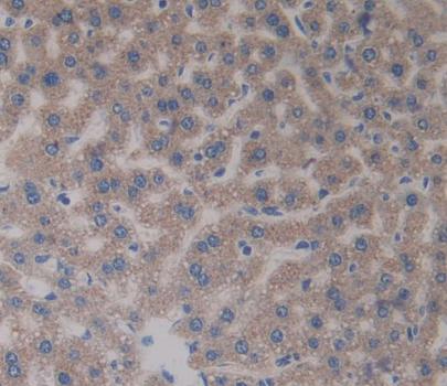 Carbonic Anhydrase VA (CA5A) Polyclonal Antibody - image 3