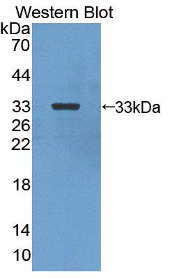 Western Blot; Sample: Lane1: Mouse Serum; Lane2: Mouse Spleen lysate; Lane3: Mouse Lung lysate; Lane4: Mouse Kidney lysate;; Lane5: Mouse Skeletal muscle lysate; Primary Ab: 1µg/mL Rabbit Anti-Mouse CA13 Antibody; Second Ab: 0.2µg/mL HRP-Linked Caprine Anti-Rabbit IgG Polyclonal Antibody;