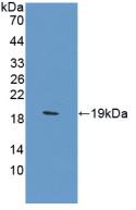 Carbonic Anhydrase XII (CA12) Polyclonal Antibody - image 2