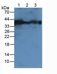 Western Blot; Sample: Recombinant CA12, Mouse.